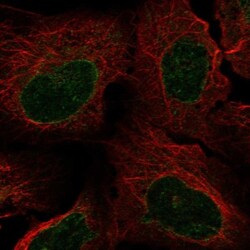 NUP62 Antibody, Novus Biologicals 25 &mu;L; Unlabeled:Antibodies, Polyclonal